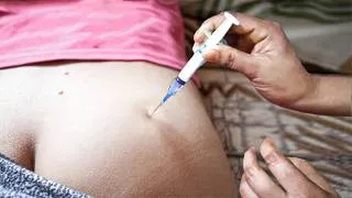 Thumbnail: IM Intramuscular Injection Ventrogluteal 💉 Ceftriaxone 500mg + Dexamethasone  Clinical nursing