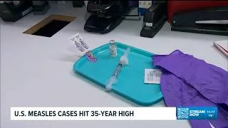 Thumbnail: Rise in measles cases in the US
