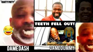 Thumbnail: DAME DASH TEETH FELL OUT BRO!!! 🤣😁