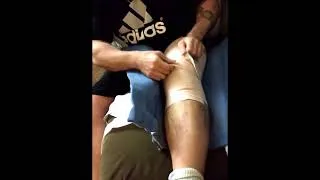 Thumbnail: First Look at Knee After Surgery - Torn Quad Tendon