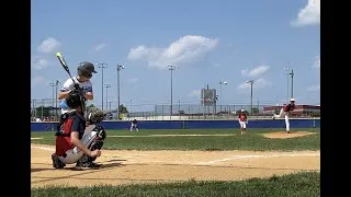 Thumbnail: 12 Yr Old Pitcher Hit in Face......Finishes Inning....💪🏼