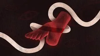 Thumbnail: Footbinding: A History