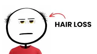 Thumbnail: Biology of Hair Loss Nobody Talks About