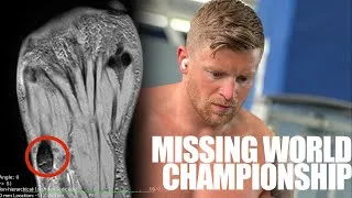 Thumbnail: How I BROKE My Foot!