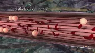 Thumbnail: Acute Inflammation- Educational 3D Animation