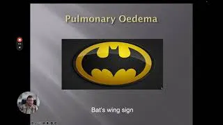 Thumbnail: Understanding Chest X rays 🩺 - Common Pathologies - Part 4 of 4