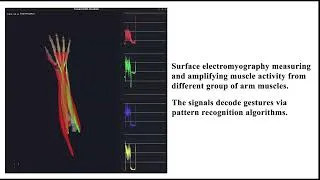Thumbnail: Towards an EMG-Based Teleop Interface and Optical Tracking System for Contact-based Cleaning Robots