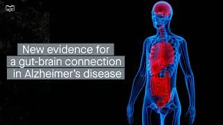Thumbnail: Risk genes affect a group of gut microbes that may protect from Alzheimer’s disease