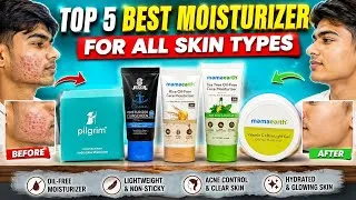 Thumbnail: top best 5 moisturizer in India 2026 in hindi | best 5 moisturizer for oily skin 