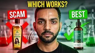 Thumbnail: Stop Buying Hair Oils! The Truth About Hair Fall & Hair Growth | ANKIT TV