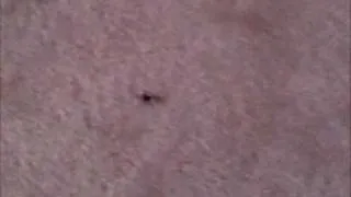 Thumbnail: glamour is my only weapon (against spiders)
