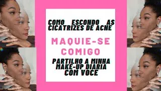 Thumbnail: Maquie-se comigo - Como esconder cicatriz de Acne no rosto #acne #maquiagem #makeup #glow up