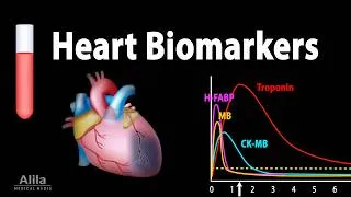 Thumbnail: Cardiac Profile Test: Routine Screening and Biomarkers Testing for Heart Attack, ACS, Animation