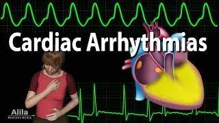 Thumbnail: Cardiac Arrhythmias Pathophysiology and ECG/EKG, Animation, Updated 2026, with Quizzes.