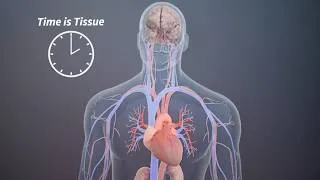 Thumbnail: LifeFlow PLUS - Rapid Infuser by 410Medical - 3D Medical Animation
