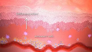 Thumbnail: How does Rocatinlimab block OX40? - 3D Medical Animation