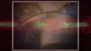 Thumbnail: REJUVENATING THE CARDIOVASCULAR SYSTEM | ADDITIONAL MUSIC | PLASMA & SCALAR ENERGY FIELDS