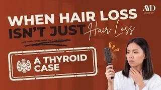 Thumbnail: When Hair Loss Isn't Just Hair Loss — A Thyroid Case