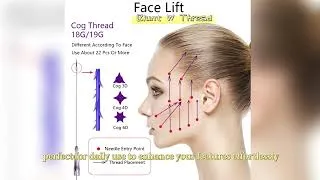 Thumbnail: Want a sculpted body without going under the knife? Discover the power of PDO Thread Lifts. 👇