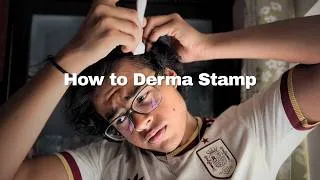 Thumbnail: NO BS Practical Guide for Derma stamping