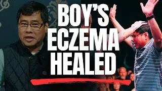 Thumbnail: Son Healed of Eczema Through the Screen