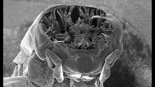 Thumbnail: See inside insects with an electron microscope and a femtosecond laser