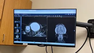 Thumbnail: MRI-Confirmed Hydrocephalus Diagnosis in Red fox kit | Reviewing Apple’s MRI findings w/ Dr. Scanlon