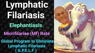 Thumbnail: Lymphatic Filariasis | Filariasis | Elephantiasis | Global program to eliminate lymphatic Filariasis