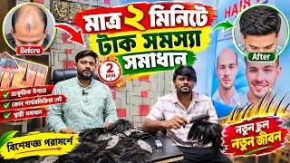 Thumbnail: সার্জারি ছাড়াই নতুন চুল🔥২ মিনিটে টাক ঢাকার সহজ উপায়🔰Hair Replacement BD😱Non Surgical Hair Replaced