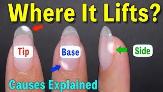Thumbnail: Why Your Gel Nails Keep Peeling Off – Causes and Fixes Explained【ASKA NAILS】