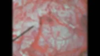 Thumbnail: Operation Crossroads :The irradiated animals by Atomic Detonations