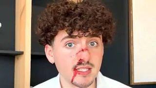 Thumbnail: The Worst Apology Video of 2026 is Here