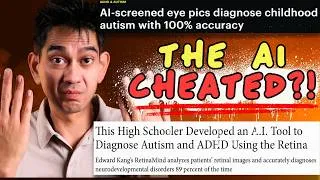 Thumbnail: The "89% Accurate" Autism Eye Test Has a BIG Problem