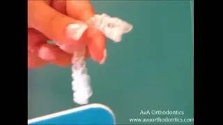 Thumbnail: 5  Filing Invisalign Tray