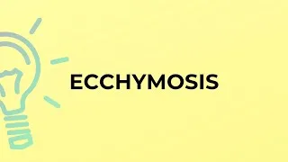 Thumbnail: What is the meaning of the word ECCHYMOSIS?