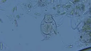 Thumbnail: Checking Rotifers Under Microscope