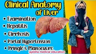 Thumbnail: Clinical Anatomy of Liver | Cirrhosis |Examination| Transplantation| TIPS | Hepatitis |Caput Medusae