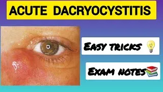 Thumbnail: Acute Dacryocystitis | Easy Tricks | #Ophthalmology #Bams