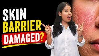 Thumbnail: जितना ज़्यादा SKINCARE करो, उतना SKIN को नुकसान?😱| Skin Barrier Repair-Ayurvedic Solution#skincare