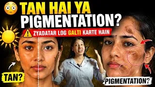 Thumbnail: TAN or PIGMENTATION? 90% log yahi galti karte hain!