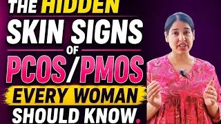 Thumbnail: PCOS/PMOS Signs on Your Face:Acne, Face Hairs & Dark Skin Explained|Ayurvedic Solutions#skincare