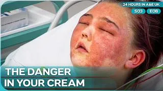 Thumbnail: Hidden Ingredient in Face Cream Caused an ER Rush | 24 Hours In A&E UK Season 3 Episode 8