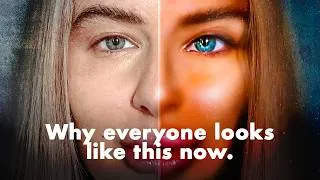 Thumbnail: The high cost of 'Instagram face'