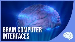 Thumbnail: Brain-Computer Interfaces: Linking Mind and Machine