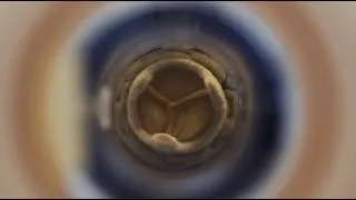 Thumbnail: BDC Labs | SFT 1000 Heart Valve Steady Flow System