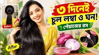 Thumbnail: মাত্র ৩ দিন পেঁয়াজের রস! 😱 চুল হবে লম্বা ও ঘন | Onion Juice Hair Growth