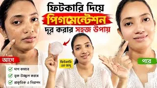 Thumbnail: 👉 ফিটকিরি দিয়ে Pigmentation কমানোর উপায় | Fitkari for Pigmentation | Before & After Result