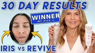 Thumbnail: The Best At-Home Laser for Wrinkles? I Did a Side-by-Side Test | Iris vs Revive