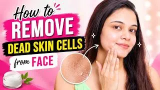 Thumbnail: ✅ Step By Step How To Remove Dead Skin Cells & Blackheads From Your face | SuperBeautyDezires