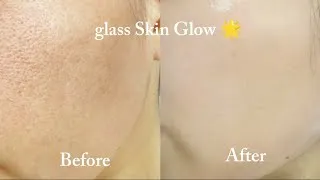 Thumbnail: DIY Face Mask for All Skin Problems | Acne, Pigmentation, Dull Skin Solution ✨